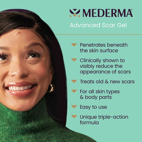 Mederma Advanced Scar Gel, Treats Old and New Scars