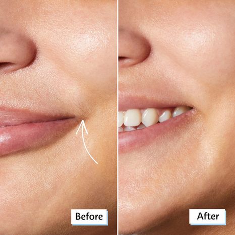 SEPHORA Collection Facial Razor Set