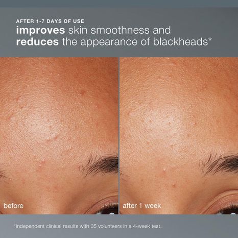 Dermalogica Daily Microfoliant Exfoliator Refill Pack