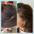 Hers Hair Regrowth Treatment, Unscented, For Women