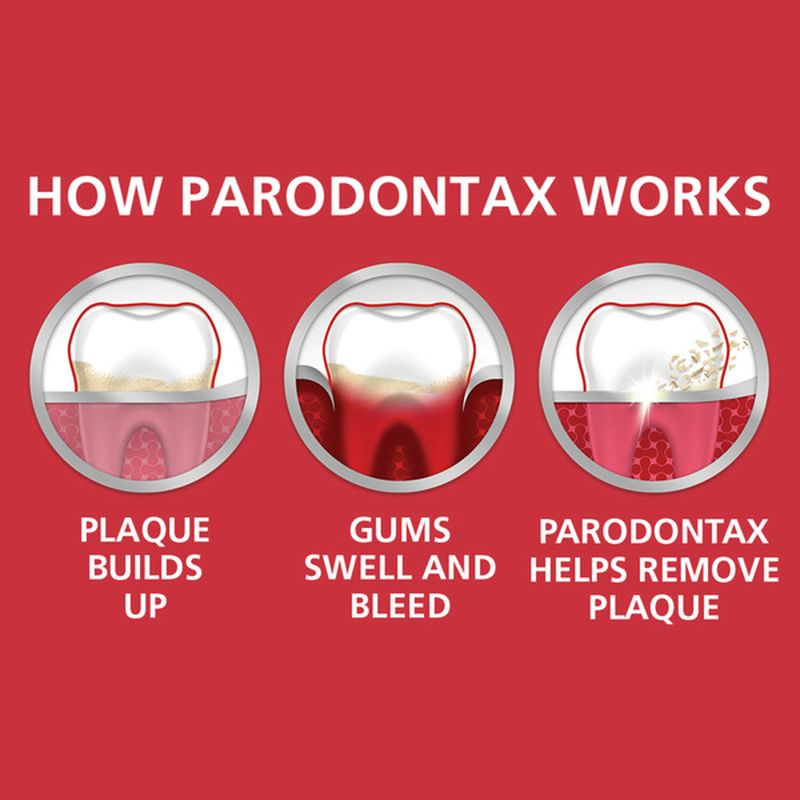 Parodontax Gingivitis Treatment Toothpaste Clean Mint, Gingivitis