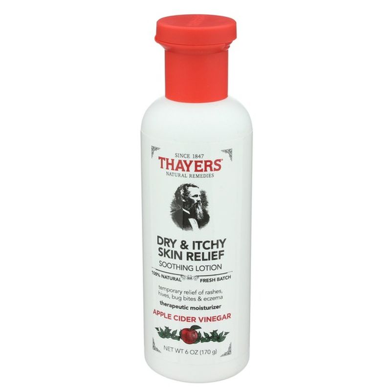 Thayers Dry & Itchy Skin Relief Soothing Lotion
